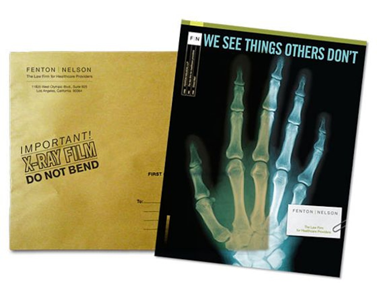 Mailer printed on an Xray of a hand